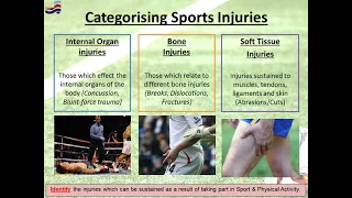GCSE PE - Sports Injuries & Prevention Methods