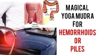 Magical Yoga Mudra to cure PILES or Hemorrhoids, Anus Fistula | Mudra for Anus related Health Issues