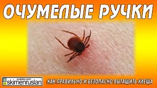 Как вытащить клеща ниткой / How to pull out a tick with a thread