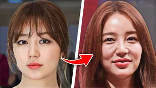 12 Korean Actors Before and After Plastic Surgery