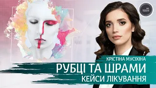 Рубці та шрами. Кейси лікування.