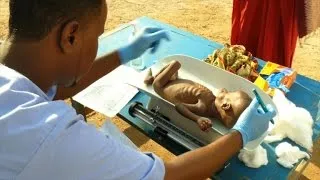 Malnutrition at record high in drought-hit Somalia: ICRC