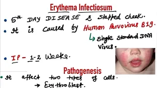 Erythema Infectiosum cause sign symptoms treatment | Parvovirus B19