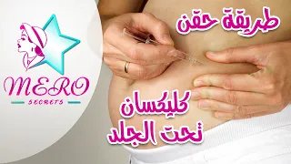 طريقة حقن الكليكسان - هيبارين - انوكسابارين - لوبارين - فراكسيبارين - اينوهيب -حقن السيولة تحت الجلد