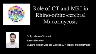 Ayushman Virmani || Role of CT & MRI in Rhino Orbito Cerebro Mucromycosis #ctbuzz2021