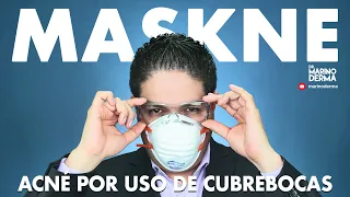 MASKNE ACNE POR USO DE CUBREBOCAS