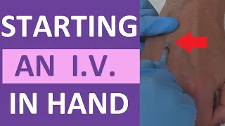 How to Start an IV | IV Catheter Insertion & Flush Technique in Hand | Nursing Skill