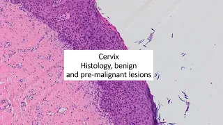 Cervical pathology part 1