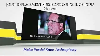 Mako Partial Knee Arthroplasty- Dr. Thomas M  Coon