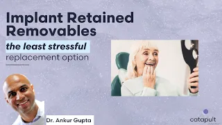 Dental Treatment: Implant Retained Overdentures | Nov 21, 2022