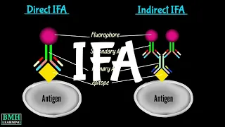 Immunofluresence Assay | IFA | Direct Immunofluresence | Indirect Immunofluresence |