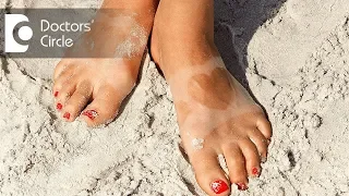 What causes suntan in individuals with wheatish complexion? - Dr. Rasya Dixit