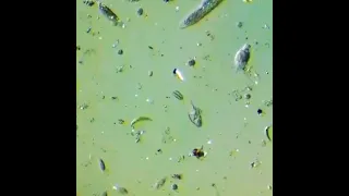 Life in a drop of water 💦 organisms found in pond water