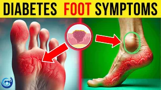 11 SCARY Signs of Diabetes Your Feet Might Be Showing | Most Are Guilty of #3