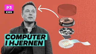 Elon Musk vil gøre mennesker til cyborgs - her er hans plan