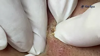 Satisfying video By Loan Nguyen Spa DaNang/ Sac Dep Spa #19