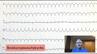 EKG-Quickie: Breitkomplextachykardie Tipps und Tricks!