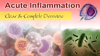 Acute Inflammation ( Clear & Complete Overview )