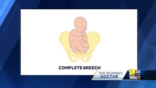 Can a 'breech' baby correct itself before birth?