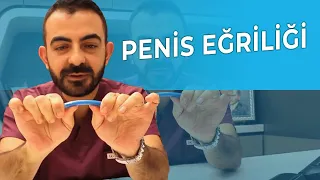 Penis Eğriliği Nedir? | Nedenleri Nelerdir? | Tedavisi Nasıl Yapılır?