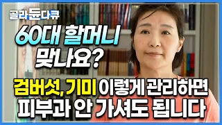 이 얼굴이 60대라면 믿으시겠습니까? 늙어 보이는 얼굴의 주범 검버섯만 없애도 10년은 젊어보일 수 있습니다! │귀하신몸│#골라듄다큐