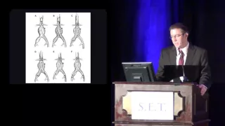 Improving Outcomes with ruptured infrarenal aneurysms