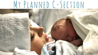 My Planned C-Section Experience (and why I had one)