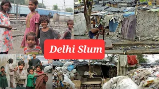 Delhi Slums population capital of india
