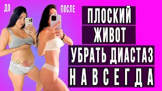 Как убрать ДИАСТАЗ и вернуть плоский живот ПОСЛЕ РОДОВ НАВСЕГДА!