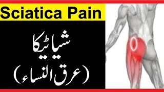 The ONE Exercise You MUST Do For Sciatica Pain Relief (WORKS FAST!) 🔥 🔥 🔥Sciatica Pain|#viralvideo