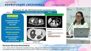 Варианты терапии меланомы кожи при прогрессировании на комбинированной таргетной и иммунотерапии.