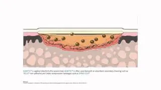 ADAPTIC™ Non-Adhering Dressing - Mode of action