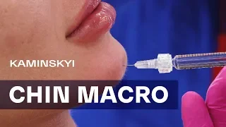 УВЕЛИЧЕНИЕ ПОДБОРОДКА. МАКРОСЪЁМКА | CHIN AUGMENTATION. MACRO★ EDGAR KAMINSKYI