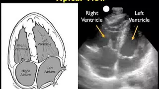 How to: Cardiac Ultrasound - Apical View