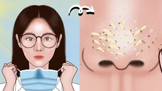 Satisfying Full Blackhead Treatment At Home! ASMR skincare animation丨Meng'sStop Motion@Medicalpart