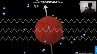 Ressonância magnética pelve - Miomas