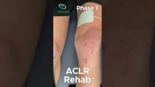 The Best Quadriceps Strengthening Exercise In Phase 1 Of ACL Reconstruction Rehab
