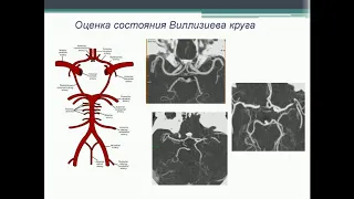 Возможности МСКТ ангиографии