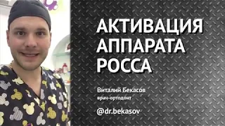 Как активировать аппарат Росса