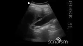 Ultrasound Challenge: SonoSim Ultrasound Challenge #2