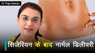 Normal Delivery is possible after Caesarean | Vaginal Birth after C section | Hindi | Dr Puja Dewan
