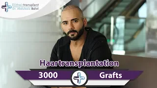 Zweite Haartransplantation Türkei | Elithairtransplant Istanbul