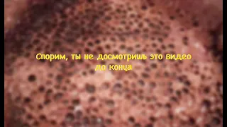 Трипофобия