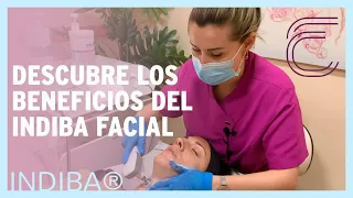 Tratamiento FACIAL INDIBA® en Valencia