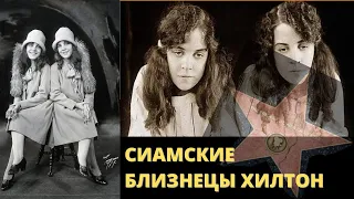 Трагическая История Сиамских Близнецов Хилтон