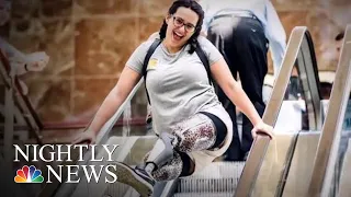 Woman Inspired To Become A Nurse After Losing Both Legs | NBC Nightly News