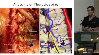 Approaches for Vertebral Augmentation - Doug Beall, MD