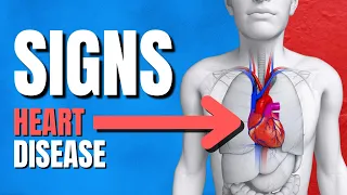 Do You Have A Heart Disease? (Cardiovascular Disease) - Doctor Explains