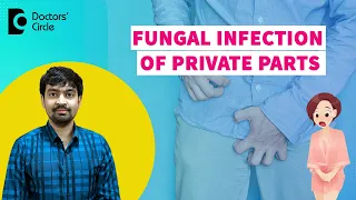 FUNGAL INFECTION OF PRIVATE PARTS| Groin Infection|Yeast Infection-Dr.Rajdeep Mysore|Doctors' Circle