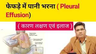 What is Pleural effusion? its Cause Symptoms and Treatment  Explained in Hindi (फेफड़े में पानी)